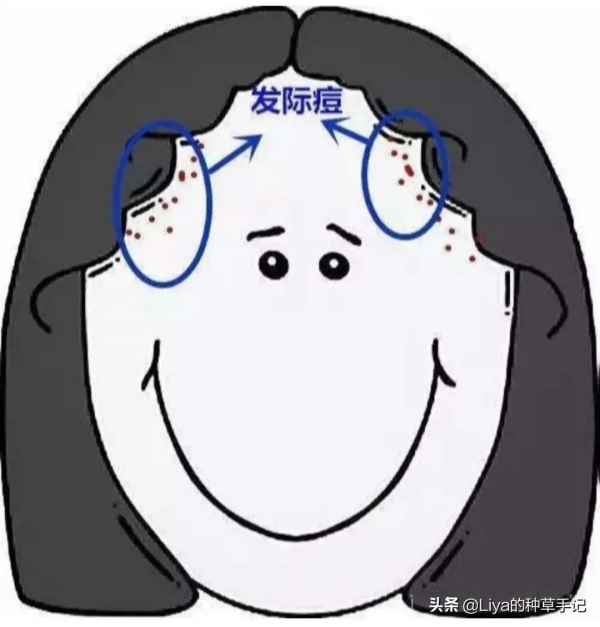 求求了，這3個“毀臉動作”不要再做了