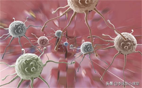 腸息肉和腸癌有什麼關係?來聽聽醫生怎麼說 腸息肉和腸癌有什麼關係?來聽聽醫生怎麼說