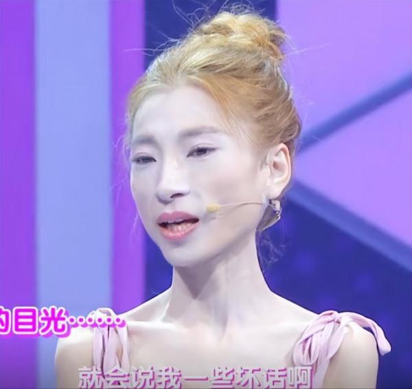 “骷髏妹”劉野：為愛痴狂，從120斤瘦到58斤，男友卻不敢見她