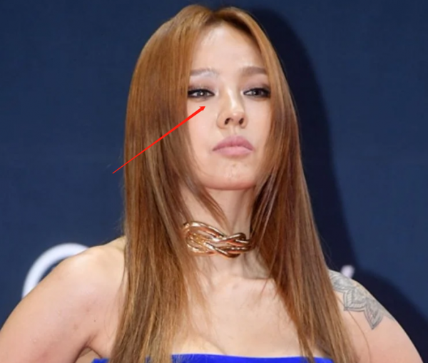 好多整容臉！外網曝韓國頒獎禮生圖，明星動鼻子後遺症太明顯