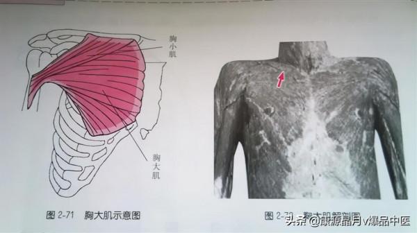 肩部疼痛的觸診圖解（很珍貴資料），值得一看