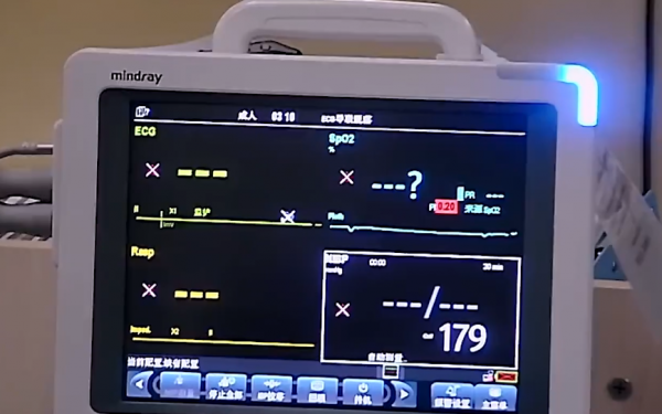 76歲老人心臟停跳半小時，搶救即將無效，2歲小孫子的話喚醒奶奶