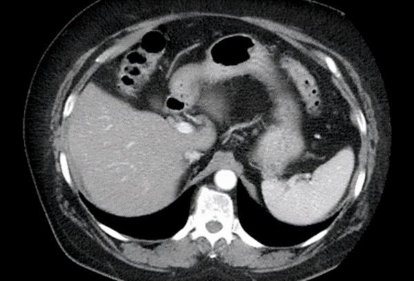 還沉迷於酒的世界嗎？天天喝酒有多可怕，快看看