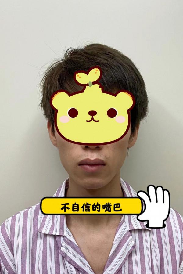 一個小改變，就可以很自信#厚唇改薄#