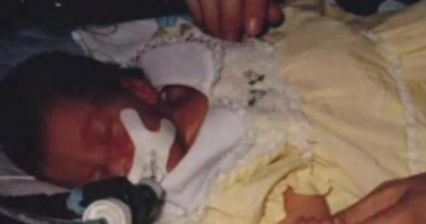 1984年,美國母親為給初生女兒續命,冒險移植狒狒心臟,最後怎樣了? 1984年,美國母親為給初生女兒續命,冒險移植狒狒心臟,最後怎樣了?