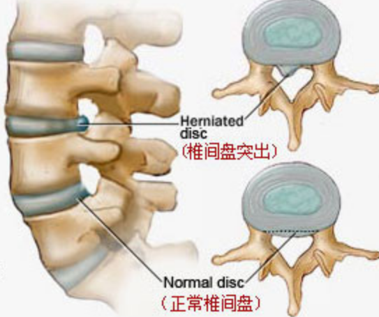 講一個 簡單的食療和外敷方，祛風散寒、通絡止痛，都沒想到吧