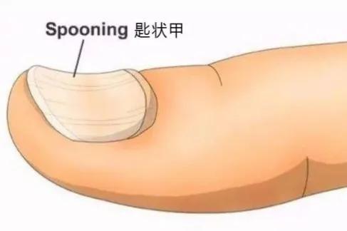 身體各部位的表現和可能缺乏的營養素對照整理！快來對照一下吧