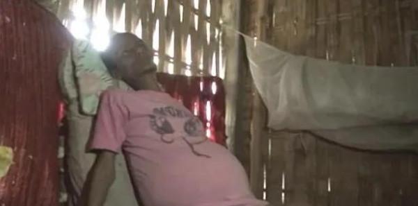 2012年男孩肚子越漲越大，每天只能睡1小時，後來怎麼樣了？