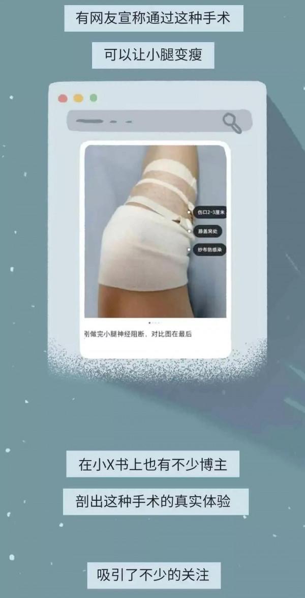 為了變美，弄殘耳朵、切斷小腿神經？漫畫：女生整容，有多瘋狂？