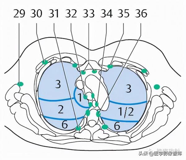 CT斷層解剖圖譜最全總結「推薦收藏」 CT斷層解剖圖譜最全總結「推薦收藏」