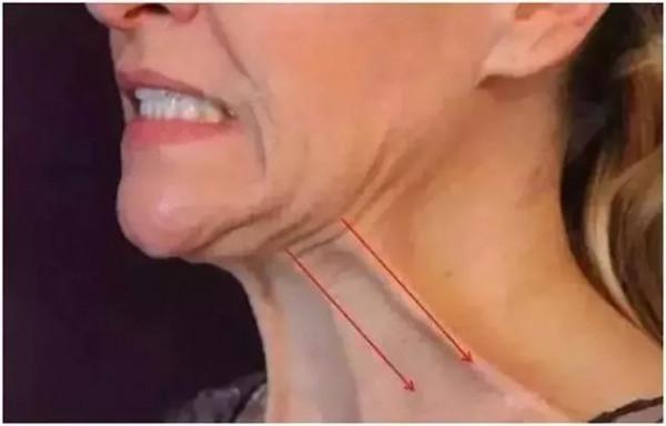 拒絕發腮，哪怕人到中年也要擁有完美下頜線