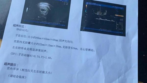 再熬41天就好了#孕晚期的煎熬吶