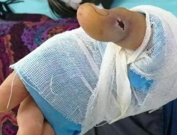 酒變成蛇的洗澡水？蛇在酒罈中泡一年，開瓶竄出咬人，為啥沒死？