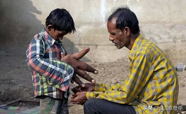 30個“慘不忍睹”的世界吉尼斯記錄,顛覆你的認知,重新整理你的三觀 30個“慘不忍睹”的世界吉尼斯記錄,顛覆你的認知,重新整理你的三觀