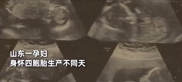 國內首例!山東孕婦懷上四胞胎,孩子卻不是同一天出生,咋回事? 國內首例!山東孕婦懷上四胞胎,孩子卻不是同一天出生,咋回事?