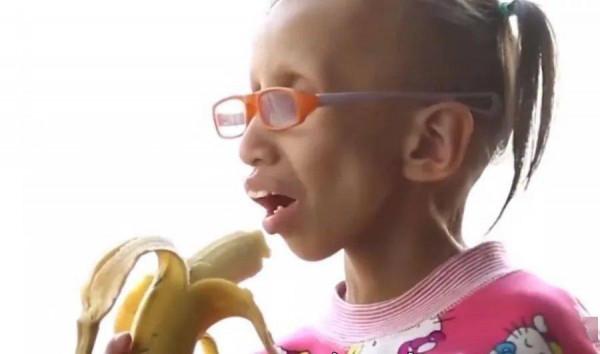 菲律賓女孩14歲參加選美，2年內滿臉皺紋，外表像60歲比她媽還老