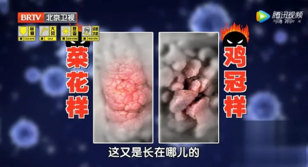 身上長出小疙瘩、紅斑，不痛不癢就沒事？警惕是惡性腫瘤潛伏體內