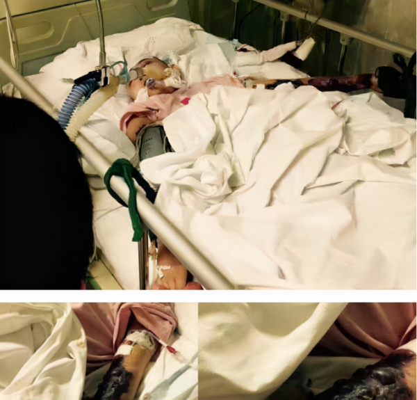 她，安徽美女，替父還債，為弟買房，25歲患淋巴癌離世，為啥？