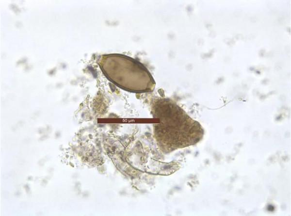 曹操墓新發現祔葬墓，可能是卞後