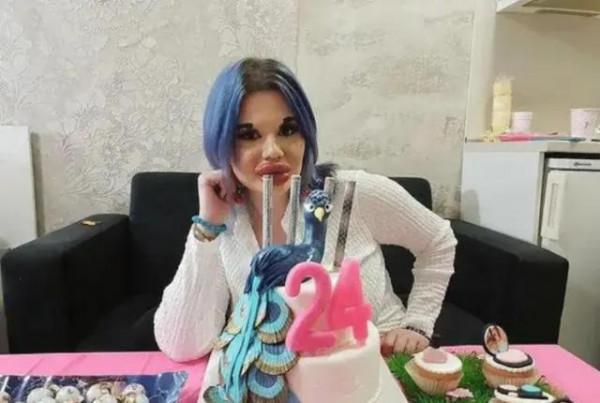 女子花費5萬元整形27次，收穫“麵包嘴”，她表示：現在自信多了