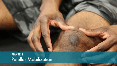 膝關節術後彎的很好，卻伸不直了？你要考慮這幾點