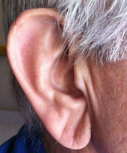 耳朵是身體的“長壽開關”每天揉一揉趕走小毛病