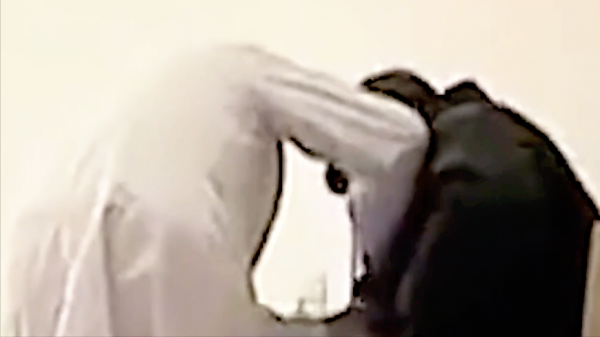 真實故事:江蘇50歲大爺去體檢,拍片檢查不到內臟,醫生難以置信 真實故事:江蘇50歲大爺去體檢,拍片檢查不到內臟,醫生難以置信