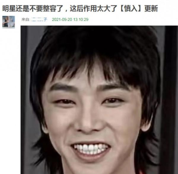 浮腫僵硬、面部扭曲!這8位動臉的男明星,堪稱“災難現場” 浮腫僵硬、面部扭曲!這8位動臉的男明星,堪稱“災難現場”