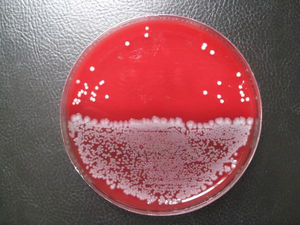 天生的“酒桶”!男子腸道自動釀酒,不喝酒也常醉倒,究竟為何? 天生的“酒桶”!男子腸道自動釀酒,不喝酒也常醉倒,究竟為何?