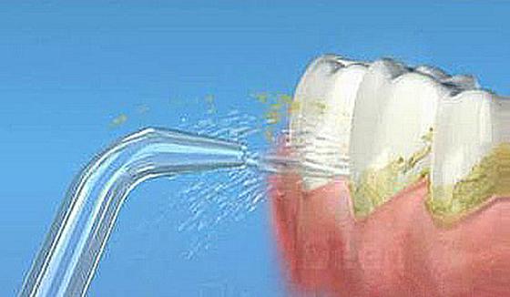 中老年人如何保護牙齒,預防牙齒鬆動脫落? 中老年人如何保護牙齒,預防牙齒鬆動脫落?