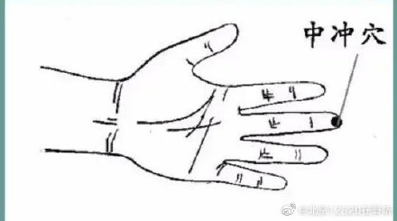 中暑急救按壓“三衝”穴