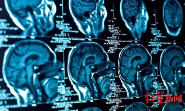 加拿大暴發神秘神經疾病：多數患者為年輕人，或已致150人中招9人死亡