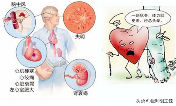 高血壓患者，長期吃降壓藥，會出現什麼結果？醫生說出實情