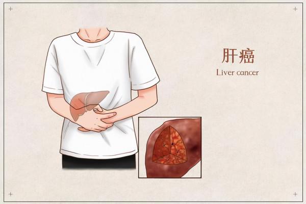 &OpenCurlyDoubleQuote;乙肝-肝硬化-肝癌&rdquo;，是肝炎患者的必然宿命嗎？4個堅持很關鍵