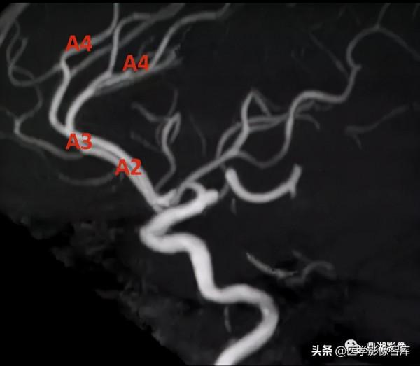 CT斷層解剖圖譜最全總結「推薦收藏」 CT斷層解剖圖譜最全總結「推薦收藏」