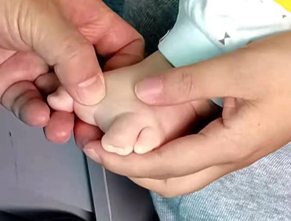 “30歲懷孕,孕6個月時發現寶寶腳有問題。”媽媽說著說著就哭了 “30歲懷孕,孕6個月時發現寶寶腳有問題。”媽媽說著說著就哭了