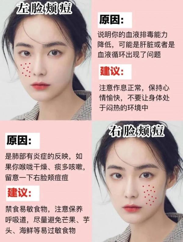 你需要的護膚小知識‘長痘原因’