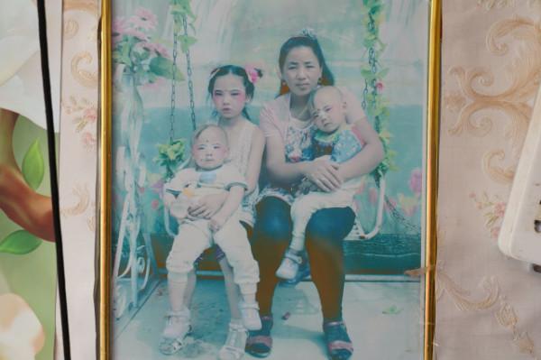 女子意外懷孕後不顧反對生下雙胞胎，醫生看後斷言：活不過18歲