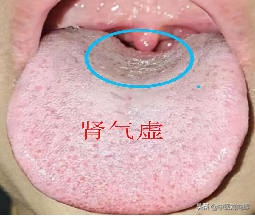 感覺氣不足，一看就會，3分鐘快速分辨哪個臟腑氣虛