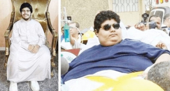 國王命令“世界最胖”少年減肥:從610kg減到63kg 國王命令“世界最胖”少年減肥:從610kg減到63kg