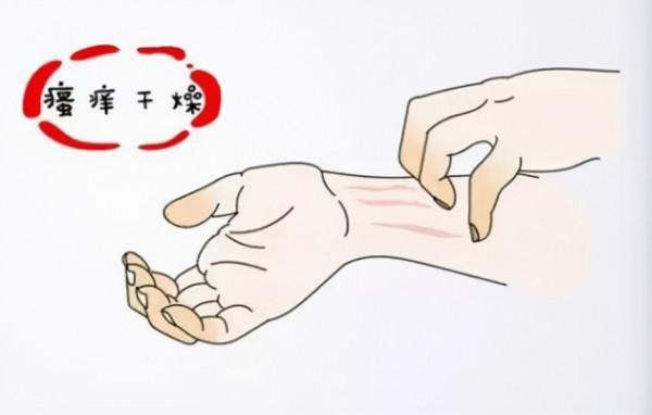 這些面板瘙癢緩解妙招,你試過了嗎 這些面板瘙癢緩解妙招,你試過了嗎