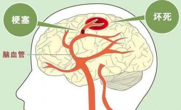 雲南&OpenCurlyDoubleQuote;茶王&rdquo;突發腦溢血離世，年僅55歲，喝茶真的可以降血壓嗎？