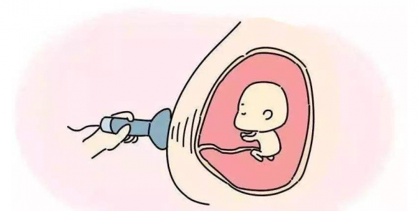 我什麼時候懷孕的？怎麼知道自己是什麼時候懷孕的呢？