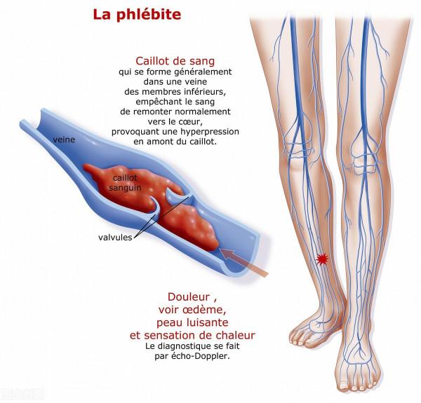 9歲男孩,剛開學就渾身無力胸部痛?醫生:罪魁禍首是躺著玩手機 9歲男孩,剛開學就渾身無力胸部痛?醫生:罪魁禍首是躺著玩手機