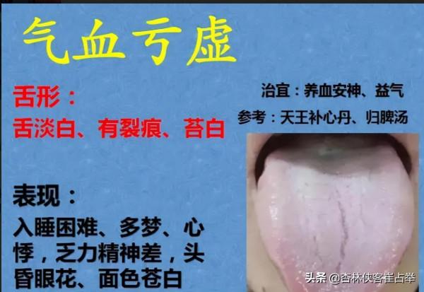 舌頭有裂紋，嘴唇還幹？送你一味湯，心血充盛，舌體自潤