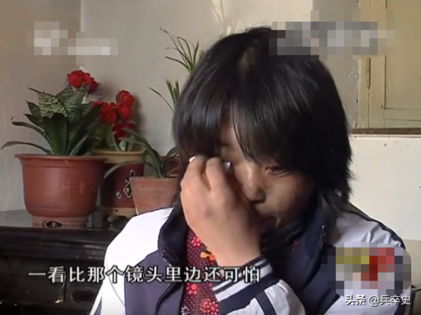 真實故事：山東女娃被開水燙成“鬼臉”，24歲結婚後又慘遭家暴