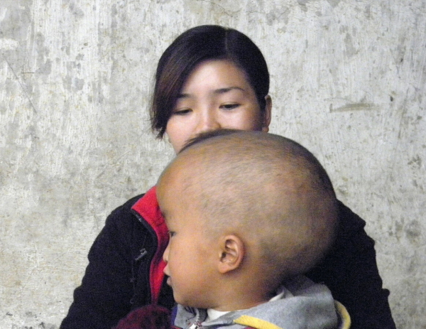 出生缺陷,克之有法 出生缺陷,克之有法