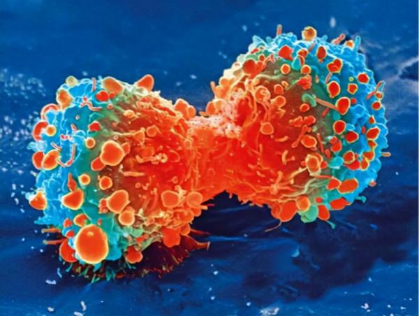 新型抗體藥物或能釋放腫瘤血管從而幫助癌症藥物的運輸 新型抗體藥物或能釋放腫瘤血管從而幫助癌症藥物的運輸