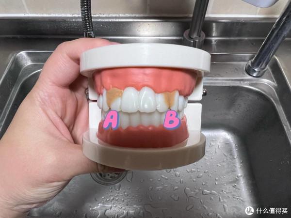 水牙線到底是不是智商稅?日常口腔護理應該注意什麼? 水牙線到底是不是智商稅?日常口腔護理應該注意什麼?