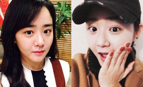 韓國初代國民妹妹，曾慘遭金範戀情背叛，後歷經4次手術險些截肢